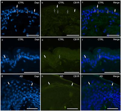 Distribution of Cannabinoid Receptors in Keratinocytes of Healthy Dogs and Dogs With Atopic Dermatitis